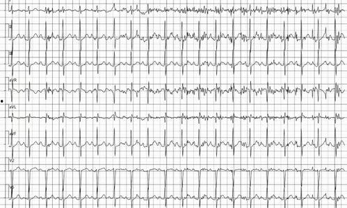 医院心电图拍照吃瓜网,揭秘医院里的“吃瓜”瞬间