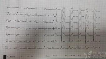 医院心电图拍照吃瓜网,揭秘医院里的“吃瓜”瞬间